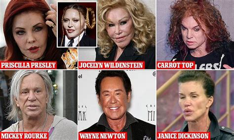 What Happens to Plastic Surgery When You Get Old? And Why Do Some People Still Look Like They’re 25 at 60?